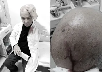 Doktora saldıran zanlı hakkında flaş karar!