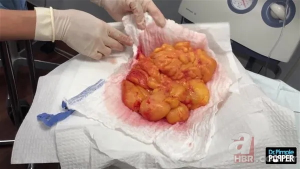 30 yıl boyunca baş ağrısıyla yaşadı! Nedeni şoke etti... 138