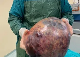 Nefes darlığı rahatsızlığıyla gitti! Gerçeği öğrenince hayatının şokunu yaşadı: Tam kilo…
