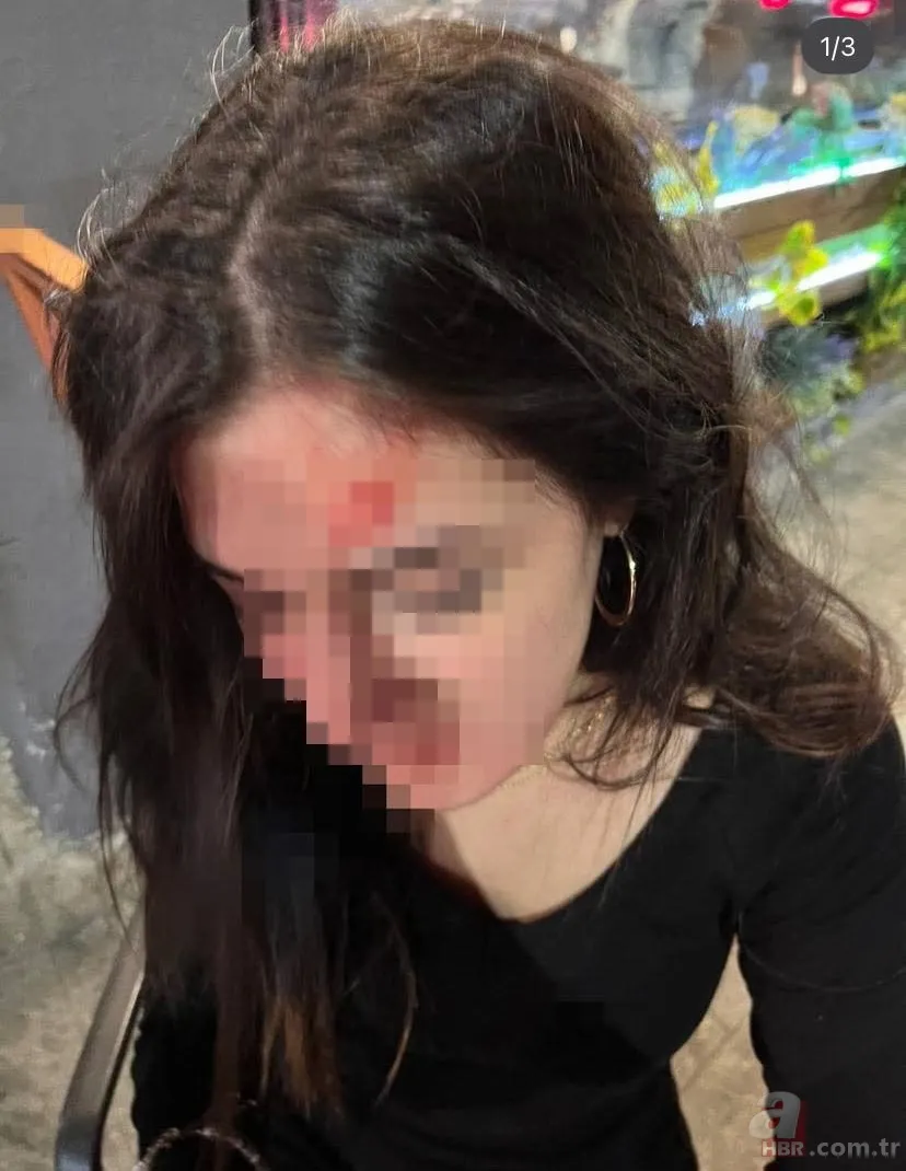 “Konuşacağız” deyip tuzak kurdu: Genç kadın dehşeti yaşadı 2