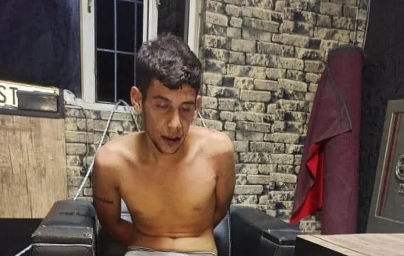 1721134259237.jpg Kerpetenle dişlerini söküp hamamböceği yedirdiler! Antalya'da kan donduran işkence: 4 yıldır kabuslarla uyanıyor - 1