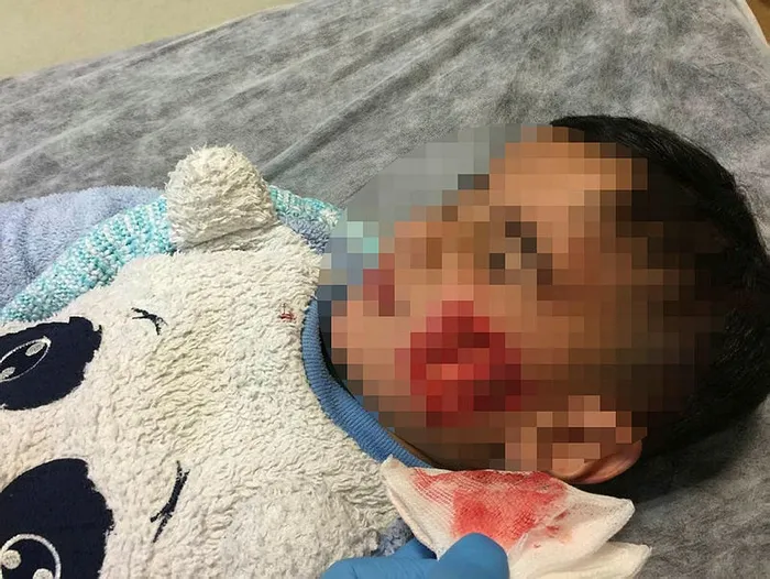 Şanlıurfa'da sokakta dehşet! 6 çocuk kanlar içerisinde kaldı, 3'ünün durumu ağır - 1