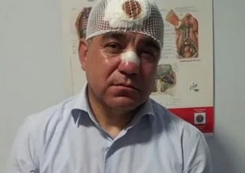 Gezi Parkı olaylarında vekilin burnunu kıran polisin cezası belli oldu