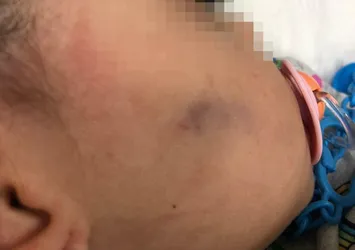 İzmir'deki anaokulundaki skandal olayın ardından flaş gelişme