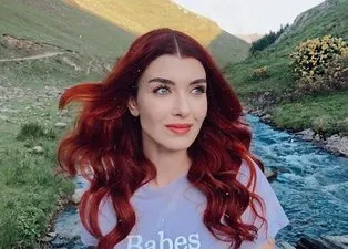 Kuzey Yıldızı İlk Aşk’ın Yıldız’ı Aslıhan Güner'in estetiksiz hali herkesi şoke etti!