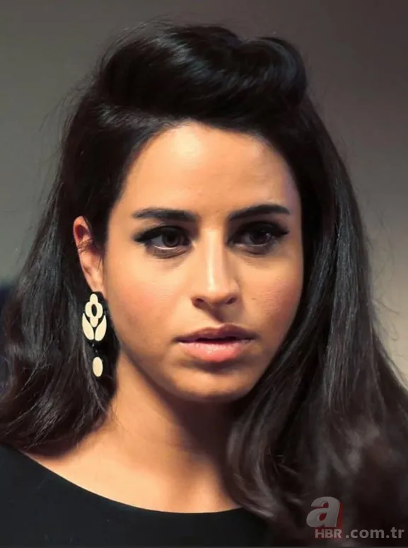 Büşra Pekin’de estetikle yeni birine dönüşenler kervanında! 1 estetiğim var deyince ti’ye alınmıştı… 4 bantla o hale gelmiş! 2