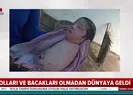 Kolları ve bacakları olmadan dünyaya geldi