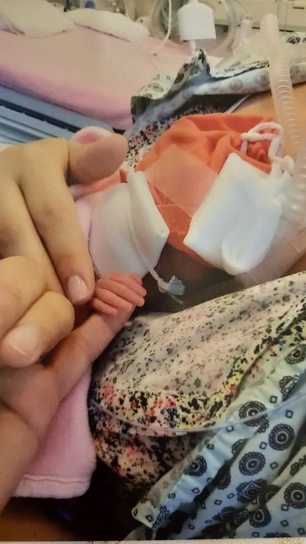 Kuvözden hayata ömürlük hayat bağı! Cesur yürekleri ve küçük parmaklarıyla yaşama tutunuyorlar - 2