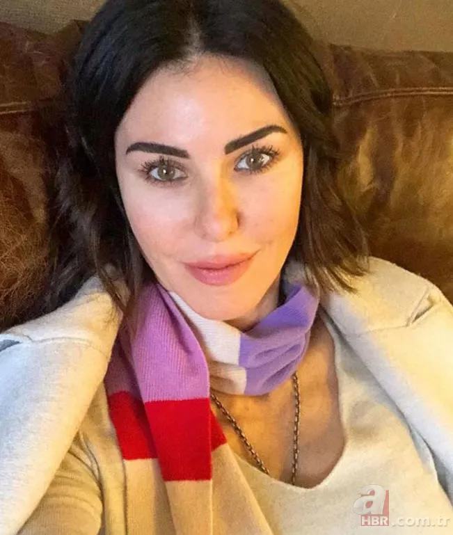 Aslı Enver'in yıllardır mücadele ettiği hastalığı ortaya çıktı | Ünlülerin hastalıkları 4