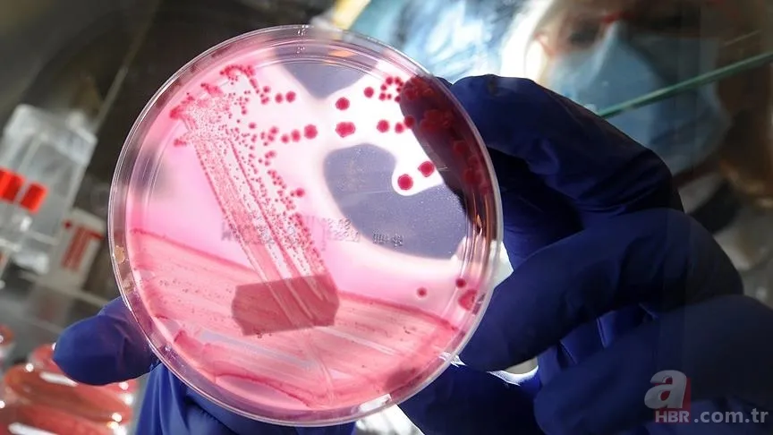 SMA hastalığı nedir, neden olur? Tedavisi var mı, belirtileri neler? SMA hangi yaşlarda kimlerde görülür? 3