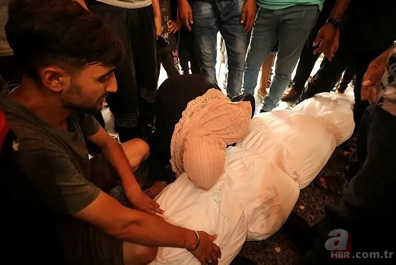 ABD'li doktor soykırımcı İsrail'in acımasızlığını herkese duyurdu: Karnından ve göğsünden vurulmuş çocuklar gördüm 7