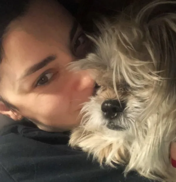 Merve Boluğur’dan bomba gibi estetik itirafı! ‘Gereksiz olduğunu düşünüyorum’