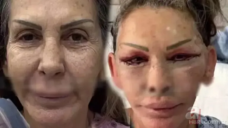 30 yaş gençleşti! Petek Dinçöz'ün annesini gören dönüp bir daha baktı 4