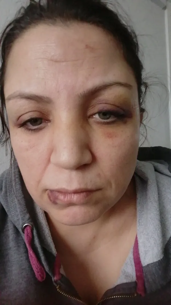1612849057563.jpg İzmir'de ev kirasını geciktiren kadına ev sahibi 6 kişiyle saldırdı! Darp anı kameralara yansıdı - 4