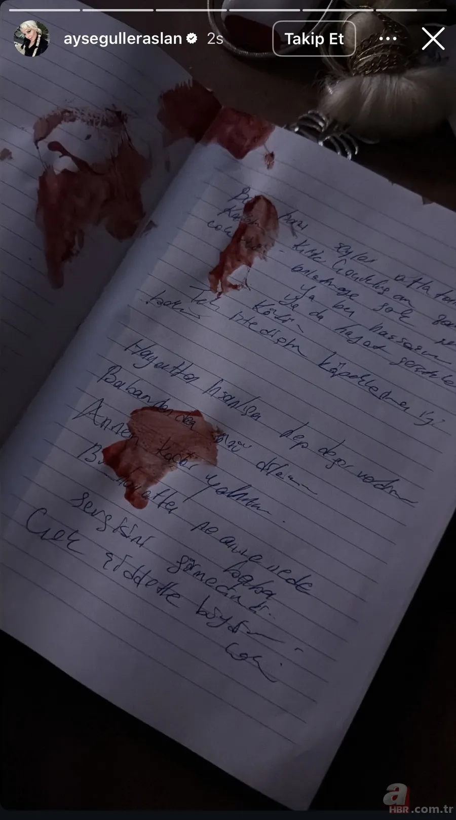 Ayşegül Eraslan cinayete mi kurban gitti? Arkadaşı otopsi raporundaki detayı paylaştı 2