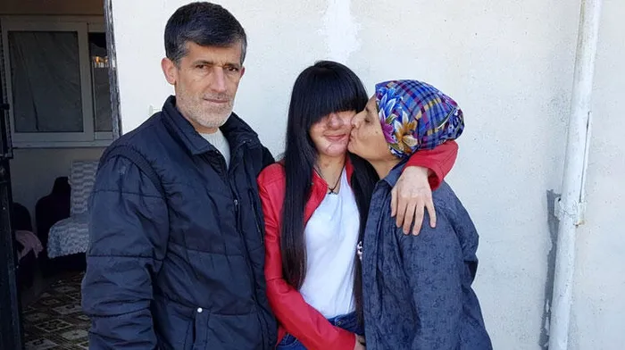Yüzüne asit döken Casim Ozan Çeltik'i affeden Berfin Özek: Kandırılmış olsam yardım isterdim - 1