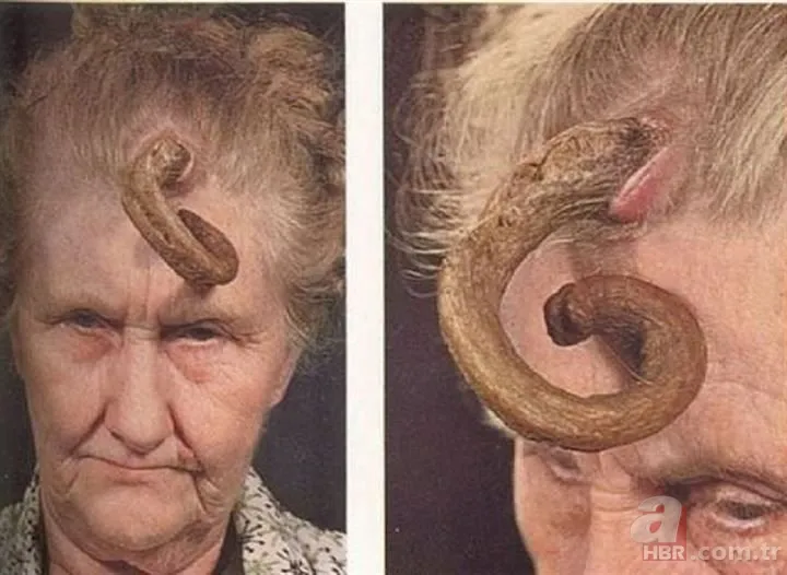 Bilim insanları şaşkın! Kafasında boynuz çıktı... 9