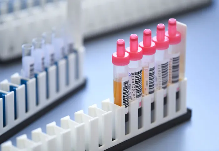 Yüzde 89 etkili! COVID-19 salgınının bitişi için büyük umut | Pfizer’den resmi hamle geldi