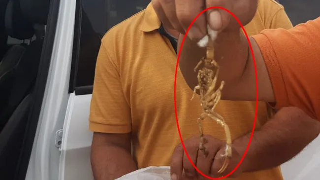 Siirt'te ayakkabasını giymeye çalışan genci akrep soktu - 1