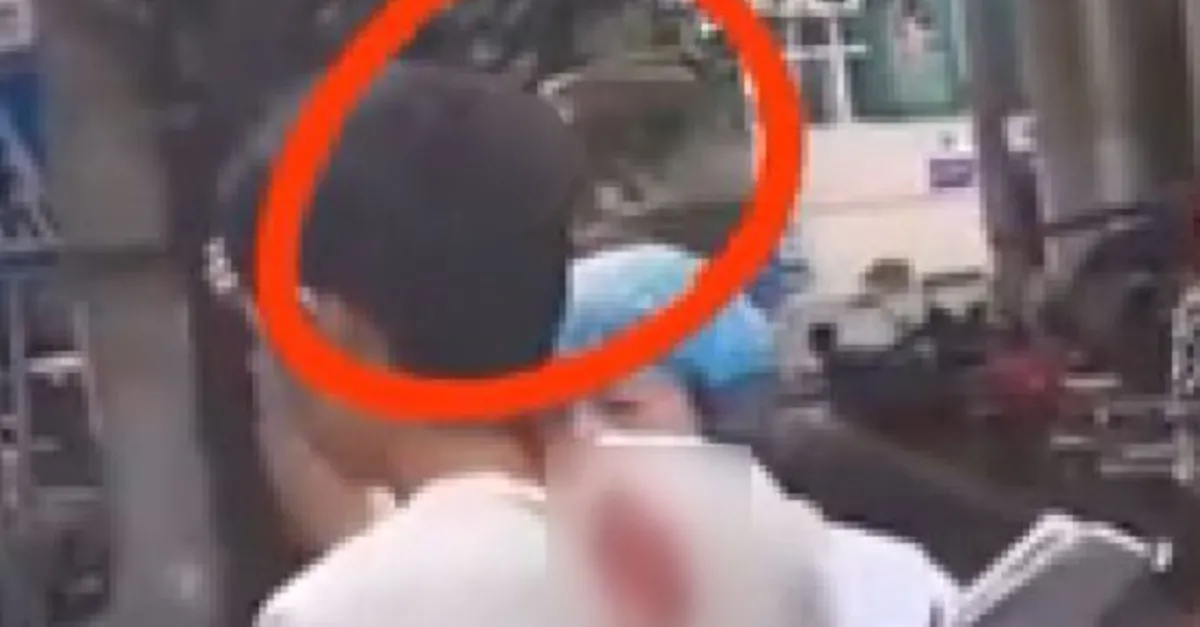 Kafasına saplı bıçakla tavırları şok etti