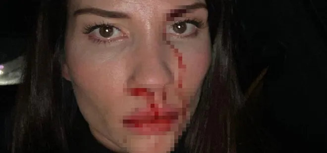 Özer Hurmacı ve Mihriban Hurmacı’nın olaylı davası! İşte hakimin son kararı