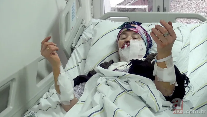 Hayvanlarını beslemek için ahıra giden kadın dehşeti yaşadı 🐄 Kurt birden saldırıp çenesini ısırdı 🐺 4