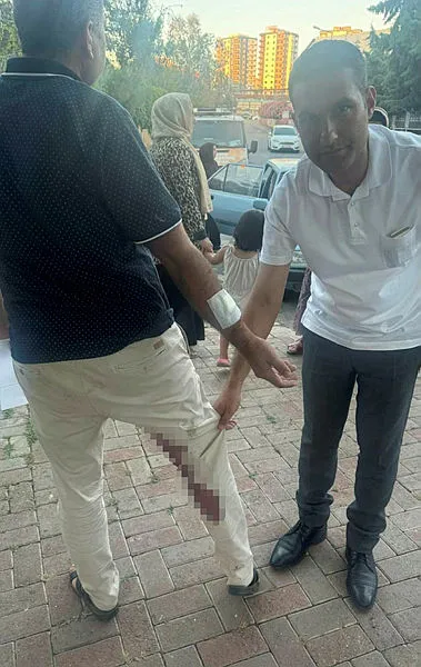 Şanlıurfa'da bir vatandaşı ısıran köpek kuduz çıktı - 1