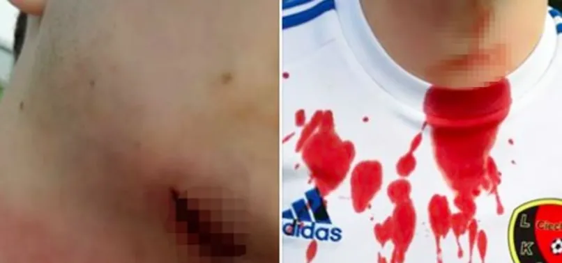 Futbol terörü! Boğazını bıçakla kesti!