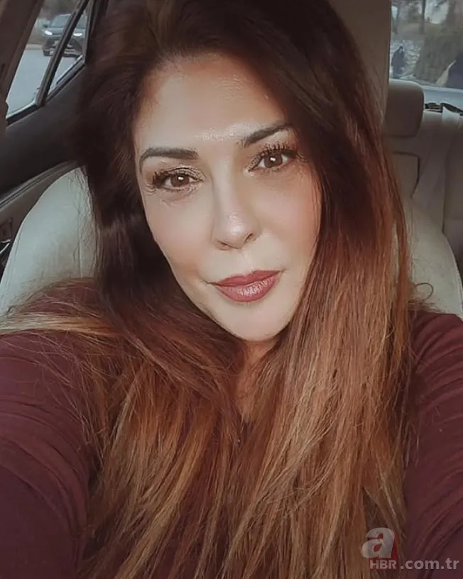 Estetik felç bırakmış! Hercai'nin yıldızı Eylem Tanrıver'in hayatı karardı 4