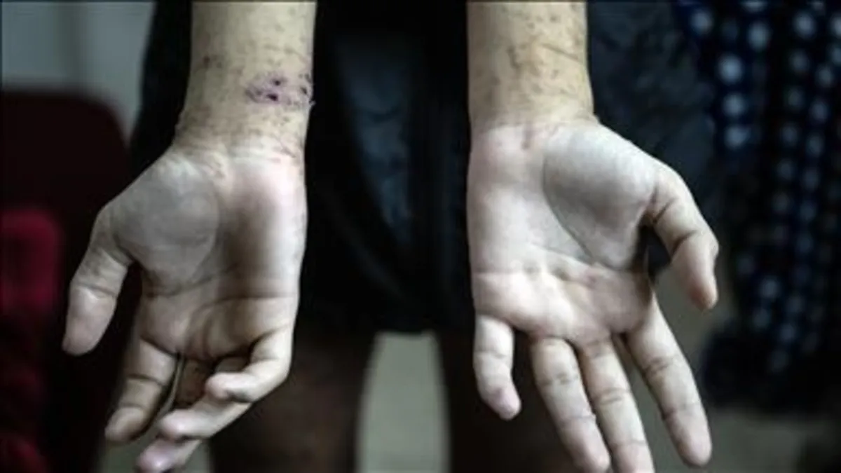 Hapishanelerdeki Gazzeli tutuklular en korkunç koşullara maruz kalıyor