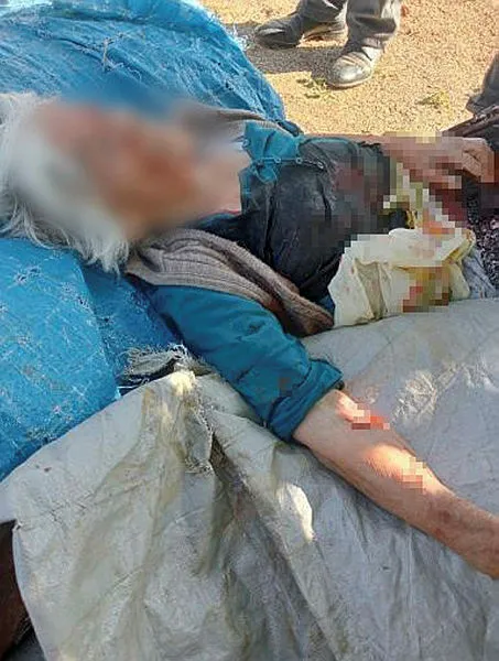 Niğde'de sokak köpeği dehşeti! Yaşlı kadın az kalsın parçalanıyordu - 1