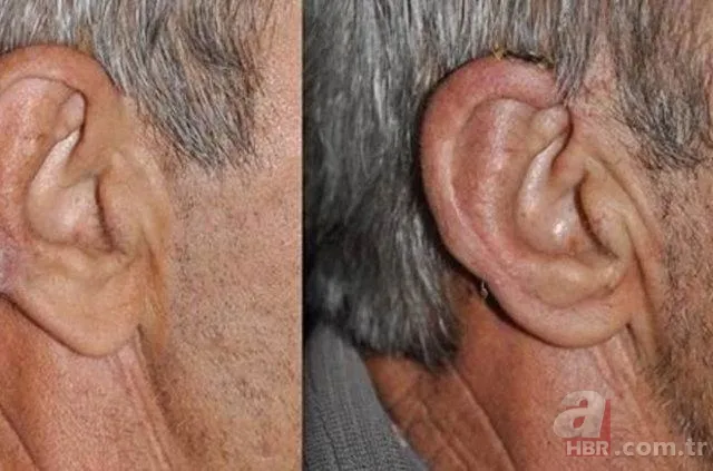 Kulak memesindeki çapraz çizgi ne işe yarar? 3