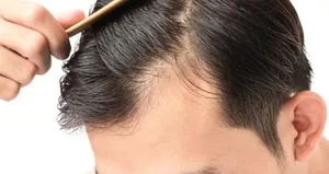 Saçı dökülenlerin yemesi gereken besinler!