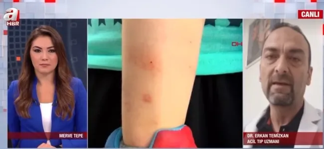 İstanbul’da sivrisinekler hastanelik ediyor! Hangi hastalıkları yayıyor?