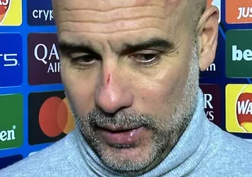 Pep Guardiola maç sonrası kendini yaraladı: Kendime zarar vermek istiyorum