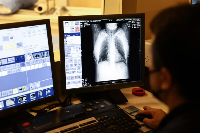 Son dakika: 50 saniyede koronavirüs (Covid-19) tespiti! Yerli yapay zekayla yüzde 95 doğruluk - 4