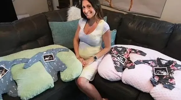 ABD’de şoke eden olay! Ultrasonda ortaya çıktı 70 milyonda bir görülüyor