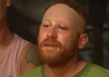 Survivor Furkan neden elendi? Survivor 2022 Furkan Kızılay'a ne oldu, sakatlandı mı? Yarışmadan neden ayrıldı?