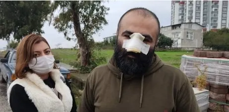 samsunda-dehset-pitbull-burnunu-kopardi-kopek-degil-sahibi-suclu-1640958782948.jpg Samsun’da dehşet! Pitbull burnunu kopardı: Köpek değil sahibi suçlu - 4