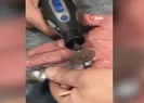 Parmağa sıkışan yüzük böyle çıkarıldı!