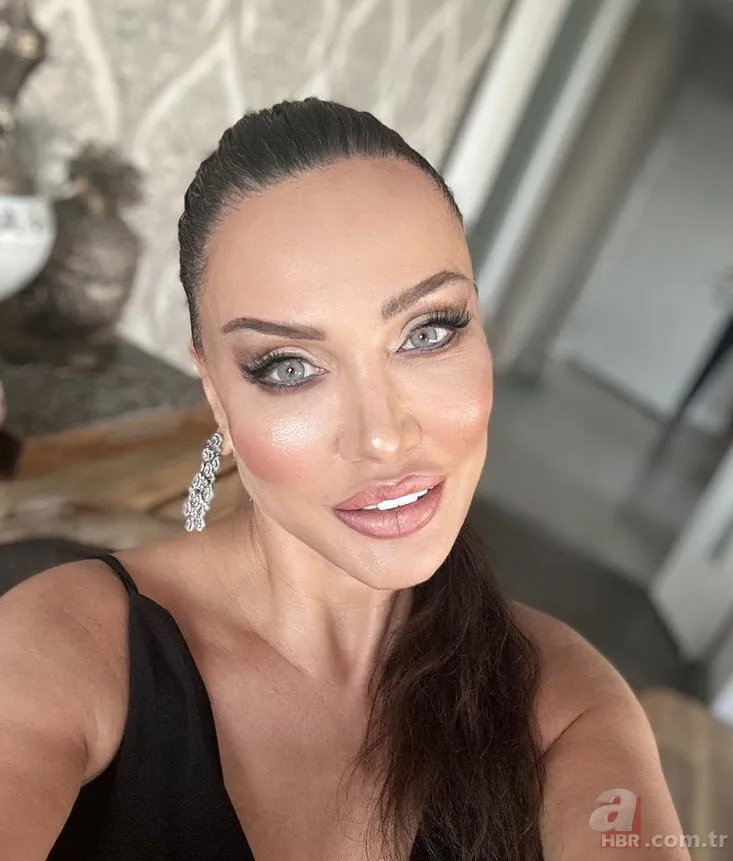 Böylesi görülmedi! Umut Akyürek bakın neresine estetik yaptırdı 10