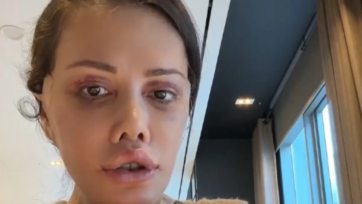 Yüz nakli olan Didem Ceran kansere yakalandı