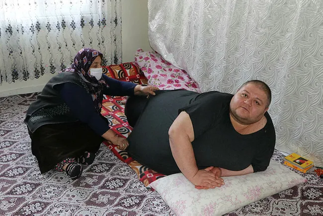 Gaziantep'te obezite hastası 280 kiloya ulaştı! Tek isteği sokakta yürümek ve çalışmak - 1