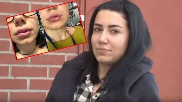 1605081112529.jpg Doktordan pes dedirten savunma! Genç kadın bu hale gelmişti... - 1