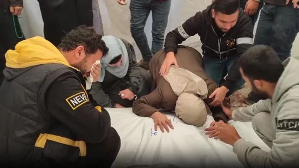 Gazze’de insanlık dramı! Dünya Sağlık Örgütü açıkladı: Gazze’de herkes açlıktan ölüyor