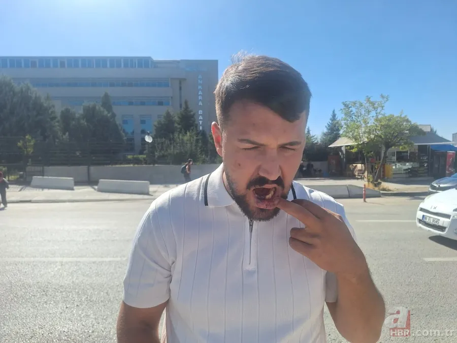 Yol verme kavgası kanlı bitti! Taksiciyi takip edip sopayla darp ettiler 3