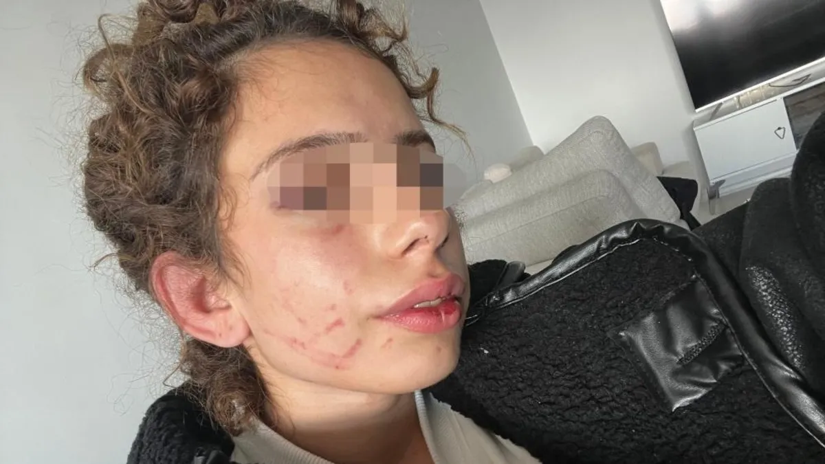 Konya'da korkunç olay! 19 yaşındaki genç kızı öldüresiye dövdü