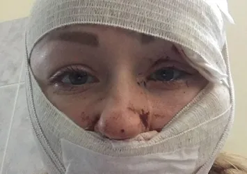 Son dakika: Falçatayla Anna Butim'in yüzünü kesmişti! Cani koca Mesut Öztürkmen'in ifadesi ortaya çıktı