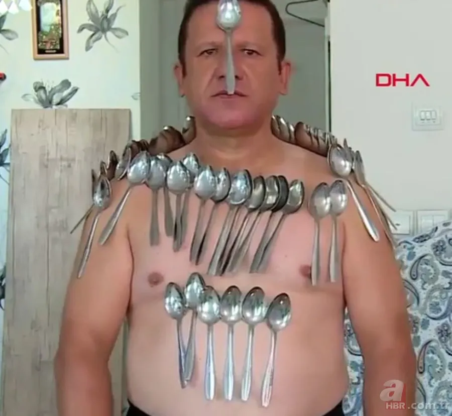 Görenler hayrete düşüyor! Ağrıları dahil her şeyi çekiyor 3