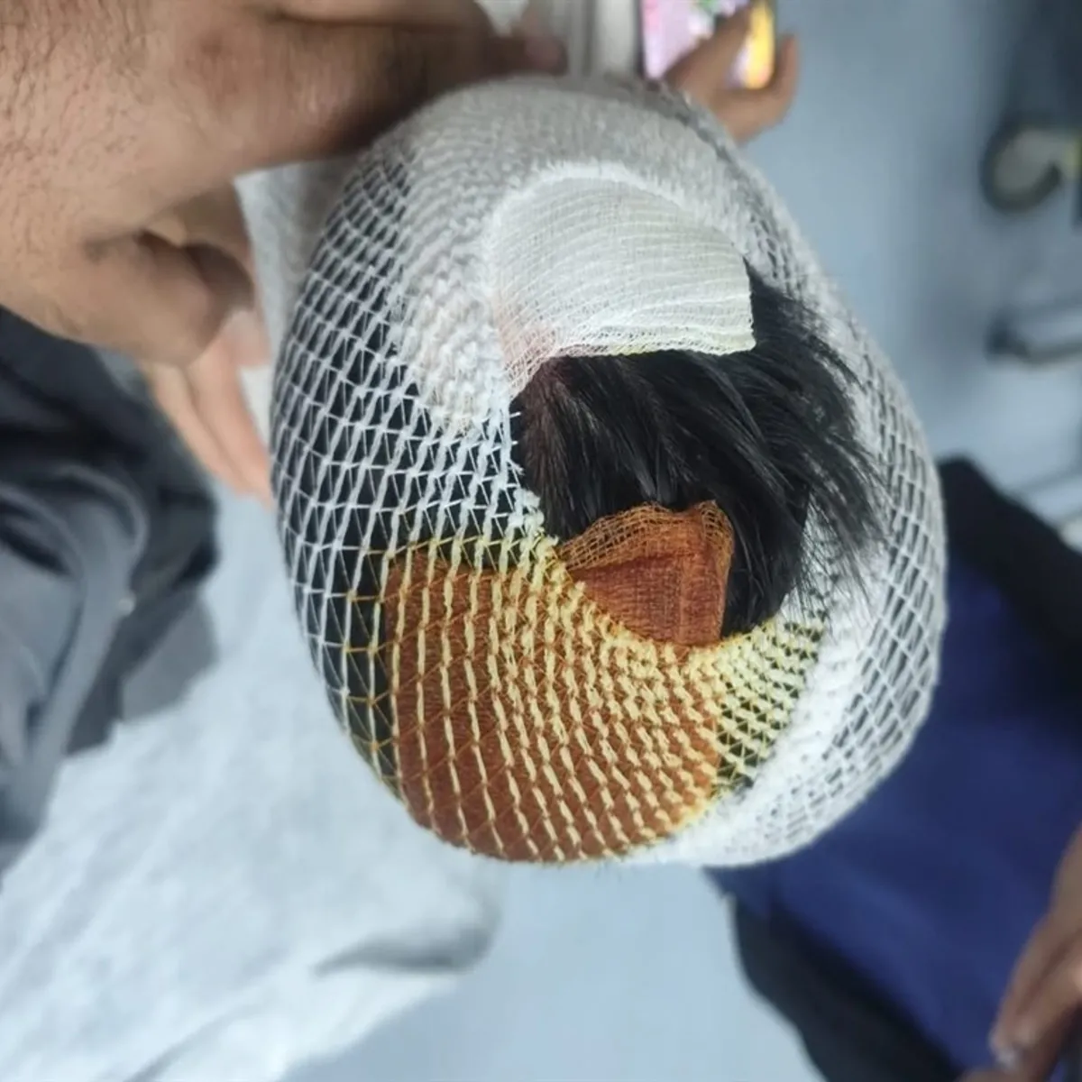 Sokak köpekleri küçük çocuğa saldırdı! İşte son durumu